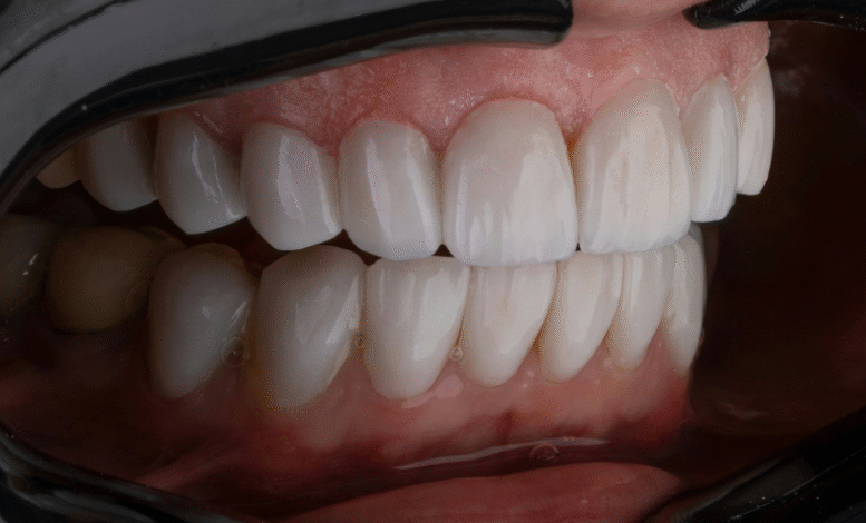 Cuide dos Seus Dentes